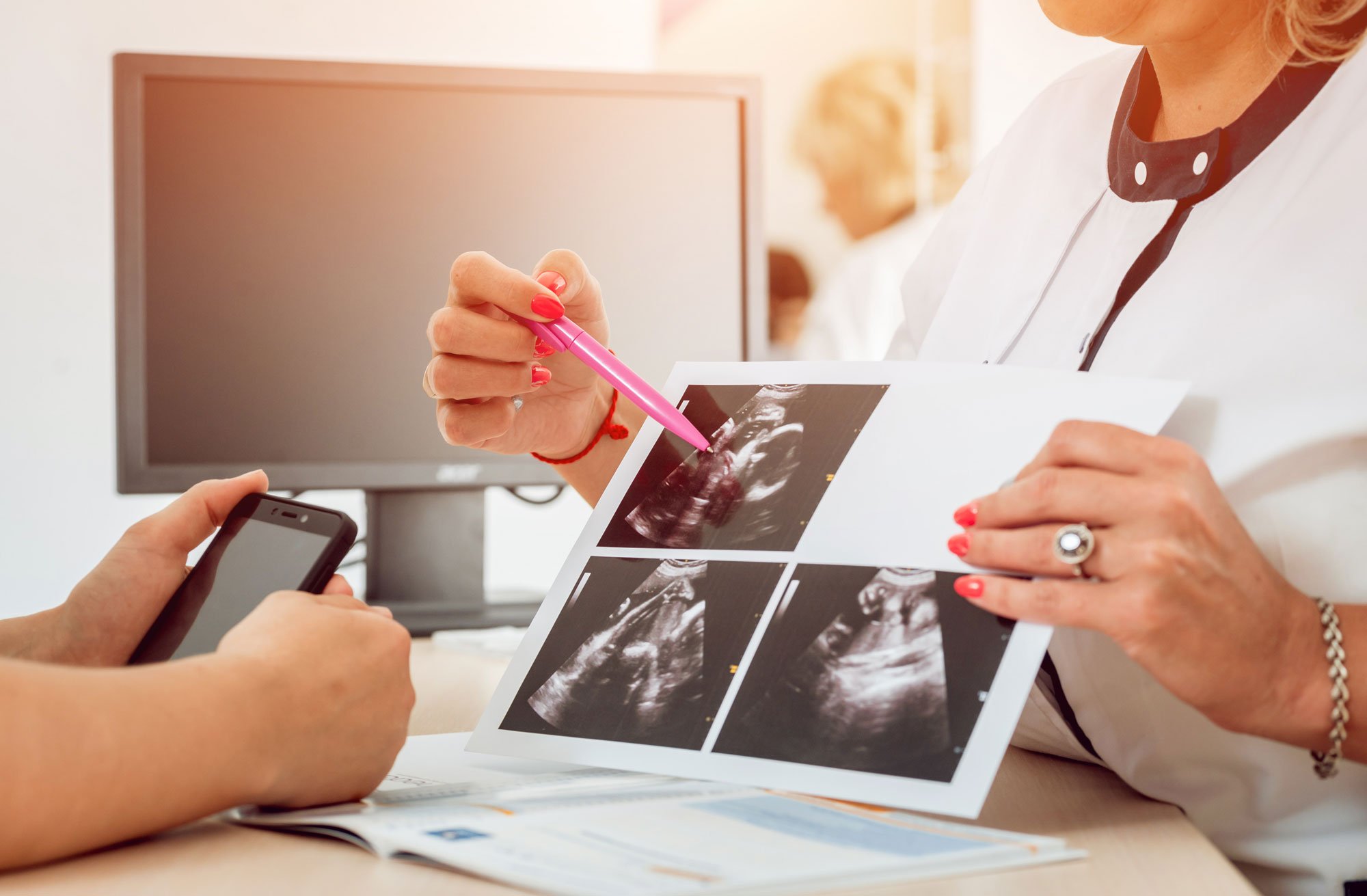 doctor-explaining-ultrasound-to-expectant-mother