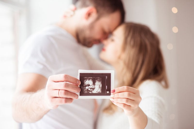 happy-couple-holding-an-ultrasound-scan