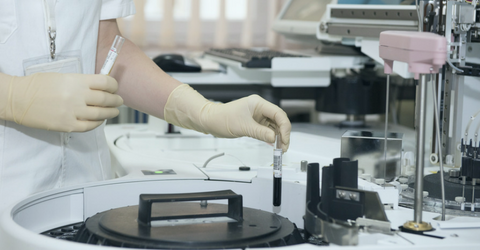 A fertility expert handling a test tube as a part of the egg freezing process