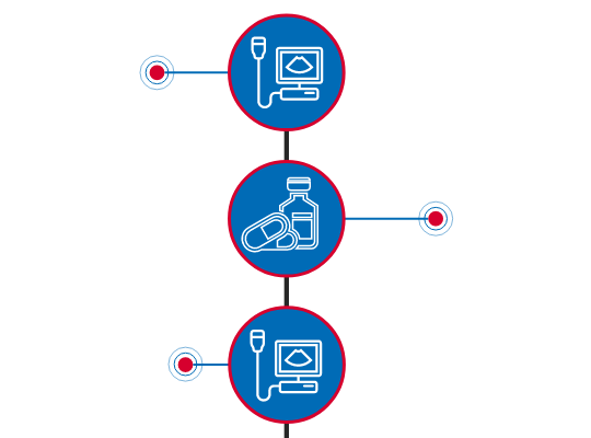 infographic-ivf-timeline