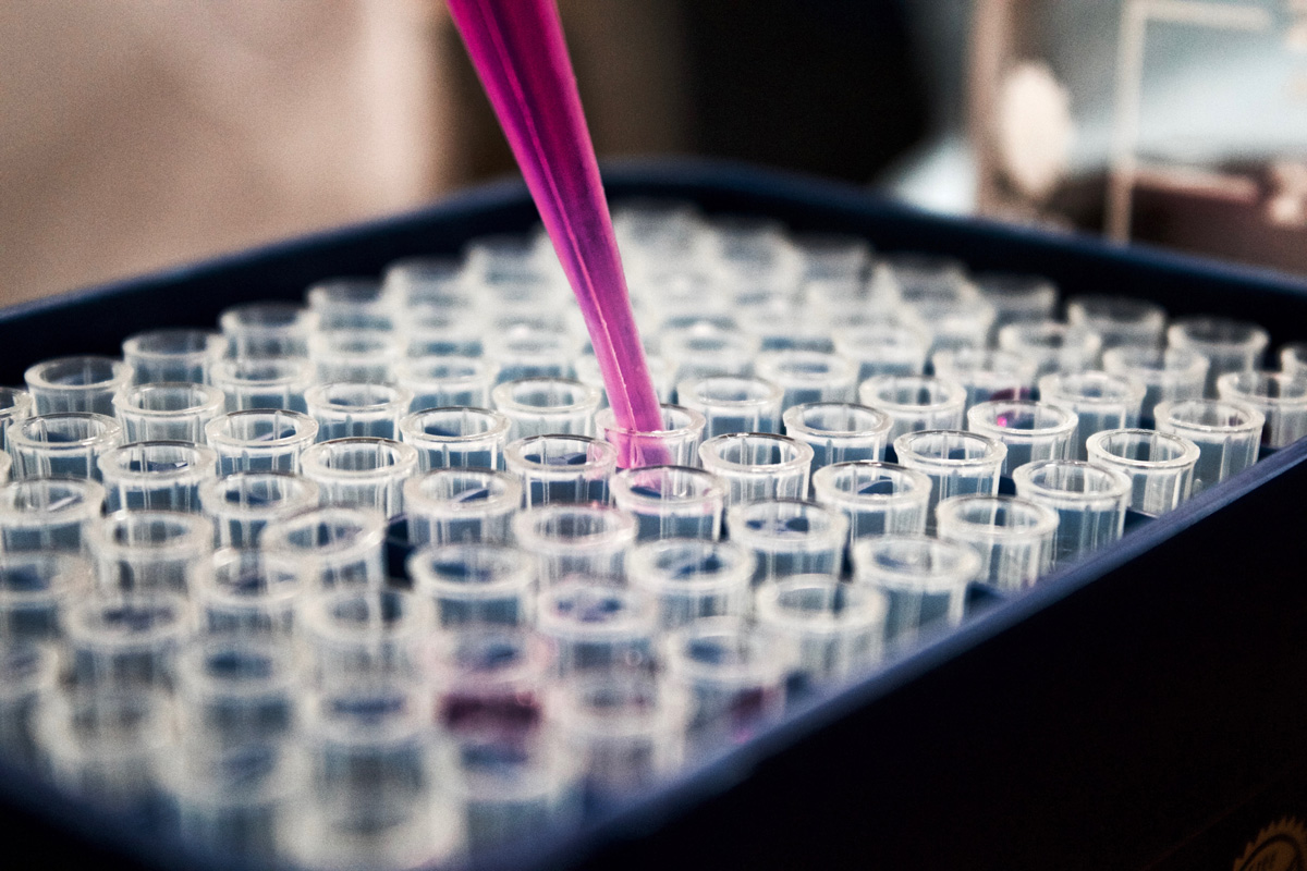 Test tubes being filled as apart of the egg freezing process