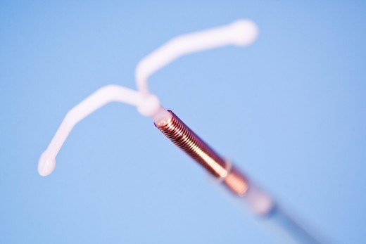 Intrauterine device and egg freezing