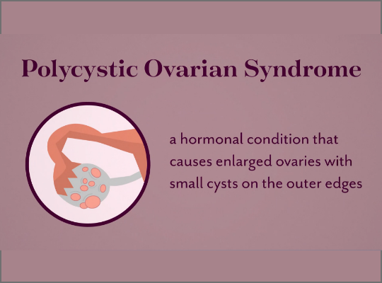 What is Polycystic Ovarian Syndrome(PCOS)? 